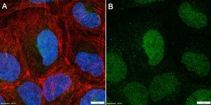 Anti-KEAP1 Antibody, clone 3B9 ZooMAb&#174; Rabbit Monoclonal recombinant, expressed in HEK 293 cells