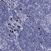 Anti-CD40LG antibody produced in rabbit Prestige Antibodies&#174; Powered by Atlas Antibodies, affinity isolated antibody, buffered aqueous glycerol solution