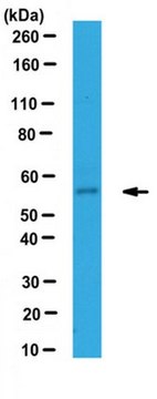 Anti-IFIT1/p56 Antibody serum, from rabbit