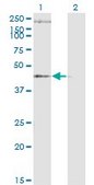 Monoclonal Anti-STEAP1 antibody produced in mouse clone 4F6-1F3, ascites fluid