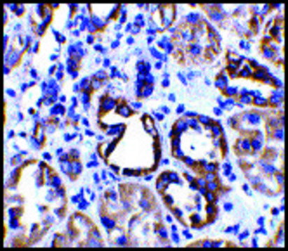 Anti-ACE2 antibody produced in rabbit affinity isolated antibody