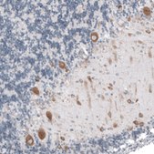 Anti-RPLP1 antibody produced in rabbit Prestige Antibodies&#174; Powered by Atlas Antibodies, affinity isolated antibody, buffered aqueous glycerol solution