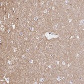 Anti-KCNQ2 antibody produced in rabbit Prestige Antibodies&#174; Powered by Atlas Antibodies, affinity isolated antibody, buffered aqueous glycerol solution