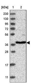 Anti-RFC3 antibody produced in rabbit Prestige Antibodies&#174; Powered by Atlas Antibodies, affinity isolated antibody, buffered aqueous glycerol solution