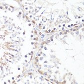 Anti-Phospho-c-Myc-T58 antibody produced in rabbit