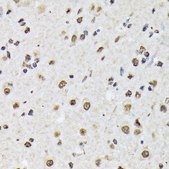 Anti-Matrin 3 antibody produced in rabbit