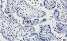 Anti-ACSL3 Antibody, clone 1I18 ZooMAb&#174; Rabbit Monoclonal recombinant, expressed in HEK 293 cells