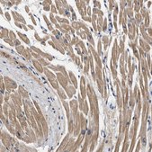 Anti-MYH3 antibody produced in rabbit Prestige Antibodies&#174; Powered by Atlas Antibodies, affinity isolated antibody, buffered aqueous glycerol solution