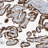 Anti-MOGS antibody produced in rabbit Prestige Antibodies&#174; Powered by Atlas Antibodies, affinity isolated antibody, buffered aqueous glycerol solution
