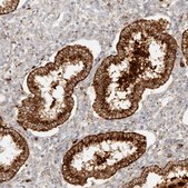 Anti-RNASET2 antibody produced in rabbit Prestige Antibodies&#174; Powered by Atlas Antibodies, affinity isolated antibody, buffered aqueous glycerol solution