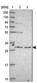 Anti-RNF170 antibody produced in rabbit Prestige Antibodies&#174; Powered by Atlas Antibodies, affinity isolated antibody, buffered aqueous glycerol solution
