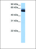 Anti-RARB antibody produced in rabbit affinity isolated antibody