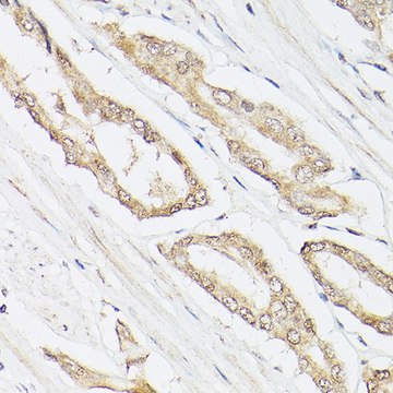 Anti-Pan Lactic acid-Lysine antibody produced in rabbit