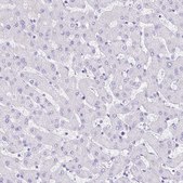 Anti-GUCA2A antibody produced in rabbit Prestige Antibodies&#174; Powered by Atlas Antibodies, affinity isolated antibody, buffered aqueous glycerol solution