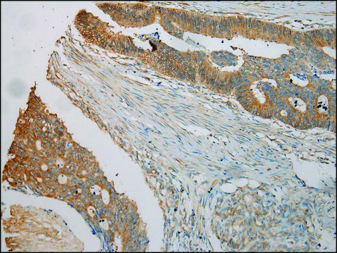 Anti-TUBA1C affinity isolated antibody