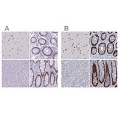 Anti-SATB2 antibody produced in rabbit Prestige Antibodies&#174; Powered by Atlas Antibodies, affinity isolated antibody, buffered aqueous glycerol solution