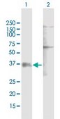 Anti-P2RY1 antibody produced in mouse purified immunoglobulin, buffered aqueous solution