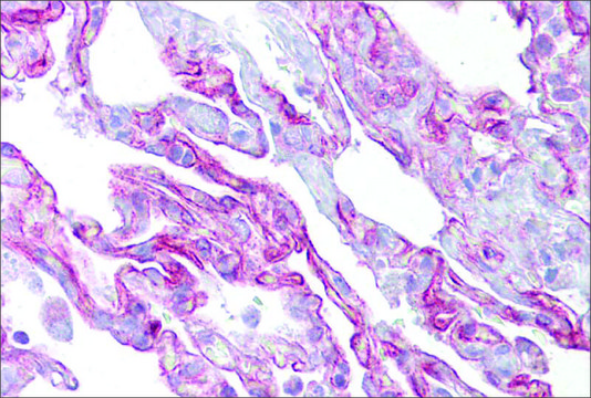 Anti-PTHLH antibody produced in rabbit affinity isolated antibody