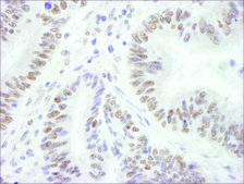 Rabbit anti-BRG1/SMARCA4 Antibody, Affinity Purified Powered by Bethyl Laboratories, Inc.