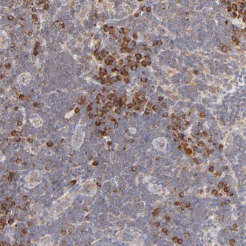 Anti-RPS20 antibody produced in rabbit Prestige Antibodies&#174; Powered by Atlas Antibodies, affinity isolated antibody, buffered aqueous glycerol solution