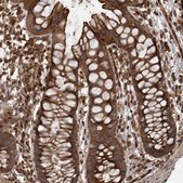 Anti-DHDDS antibody produced in rabbit Prestige Antibodies&#174; Powered by Atlas Antibodies, affinity isolated antibody, buffered aqueous glycerol solution, Ab2
