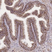 Anti-GSTM1 antibody produced in rabbit Prestige Antibodies&#174; Powered by Atlas Antibodies, affinity isolated antibody, buffered aqueous glycerol solution