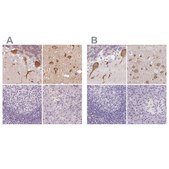 Anti-MAP1A antibody produced in rabbit Prestige Antibodies&#174; Powered by Atlas Antibodies, affinity isolated antibody, buffered aqueous glycerol solution