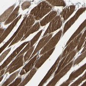 Anti-CACNA2D1 antibody produced in rabbit affinity isolated antibody, buffered aqueous glycerol solution