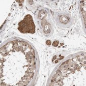 Anti-KIF21B antibody produced in rabbit Prestige Antibodies&#174; Powered by Atlas Antibodies, affinity isolated antibody, buffered aqueous glycerol solution