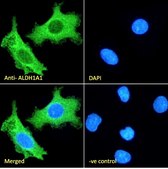 Anti-ALDH1A1, C-Terminal antibody produced in goat affinity isolated antibody, buffered aqueous solution