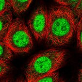 Anti-ZIC4 antibody produced in rabbit Prestige Antibodies&#174; Powered by Atlas Antibodies, affinity isolated antibody, buffered aqueous glycerol solution
