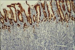 Anti-Mucin MUC5AC Antibody, clone CLH2 clone CLH2, Chemicon&#174;, from mouse