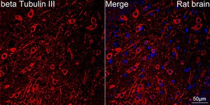 Anti-&#946;III-Tubulin Antibody, clone 6X6H6, Rabbit Monoclonal