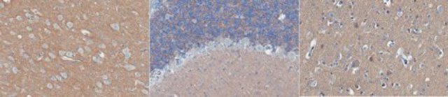 Anti-Catenin delta-2 Antibody, clone 4H2.1 clone 4H2.1, from mouse
