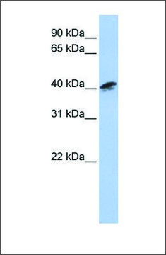 Anti-ACTR1A antibody produced in rabbit affinity isolated antibody