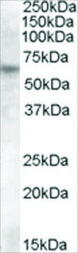 Anti-RPE65 antibody produced in goat affinity isolated antibody, buffered aqueous solution