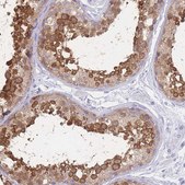 Anti-LZTFL1 antibody produced in rabbit Prestige Antibodies&#174; Powered by Atlas Antibodies, affinity isolated antibody, buffered aqueous glycerol solution