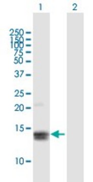 Anti-MGP antibody produced in mouse purified immunoglobulin, buffered aqueous solution