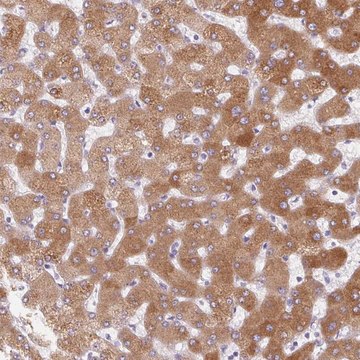 Anti-LPA antibody produced in rabbit Prestige Antibodies&#174; Powered by Atlas Antibodies, affinity isolated antibody, buffered aqueous glycerol solution