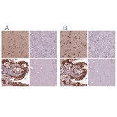 Anti-SRI antibody produced in rabbit Prestige Antibodies&#174; Powered by Atlas Antibodies, affinity isolated antibody