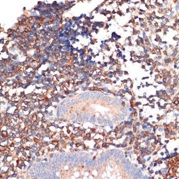 Anti-EHD1 antibody produced in rabbit