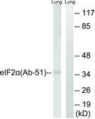 Anti-EIF2 &#945; antibody produced in rabbit affinity isolated antibody