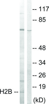 Anti-Histone H2B antibody produced in rabbit affinity isolated antibody