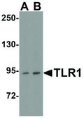 Anti-TLR1 (ab2) antibody produced in rabbit affinity isolated antibody, buffered aqueous solution