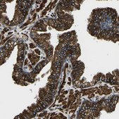 Anti-KCNJ15 antibody produced in rabbit Prestige Antibodies&#174; Powered by Atlas Antibodies, affinity isolated antibody, buffered aqueous glycerol solution