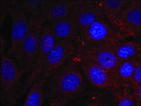 Anti-phospho-SNCA (pTyr136) antibody produced in rabbit affinity isolated antibody
