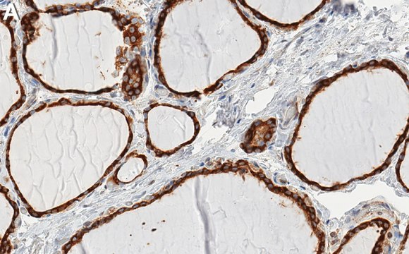 Anti-Cyclophilin B Antibody, clone 4D5 ZooMAb&#174; Rabbit Monoclonal recombinant, expressed in HEK 293 cells