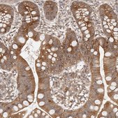 Anti-AFDN antibody produced in rabbit Prestige Antibodies&#174; Powered by Atlas Antibodies, affinity isolated antibody, buffered aqueous glycerol solution, ab2