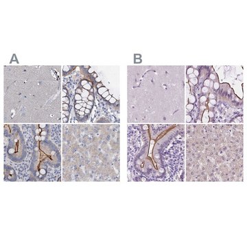 Anti-ACY3 antibody produced in rabbit Prestige Antibodies&#174; Powered by Atlas Antibodies, affinity isolated antibody, buffered aqueous glycerol solution