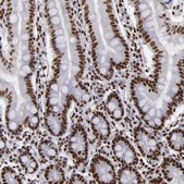 Anti-MRE11 antibody produced in rabbit Prestige Antibodies&#174; Powered by Atlas Antibodies, affinity isolated antibody, buffered aqueous glycerol solution